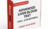 Liver Blood Test Guide for Residents in Maidstone