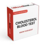 High Cholesterol Blood Test: Quick Guide for Blackpool Residents